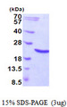 HSPB6 / HSP20 Protein