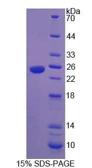 HSPB7 / CvHSP Protein - Recombinant Heat Shock Protein Beta 7 By SDS-PAGE