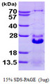 HSPB7 / CvHSP Protein