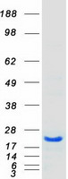 HSPB7 / CvHSP Protein - Purified recombinant protein HSPB7 was analyzed by SDS-PAGE gel and Coomassie Blue Staining