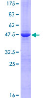 HSPB8 / H11 / HSP22 Protein - 12.5% SDS-PAGE of human HSPB8 stained with Coomassie Blue