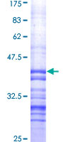 HSPB8 / H11 / HSP22 Protein - 12.5% SDS-PAGE Stained with Coomassie Blue.