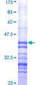 HSPB8 / H11 / HSP22 Protein - 12.5% SDS-PAGE Stained with Coomassie Blue.