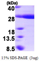 HSPB8 / H11 / HSP22 Protein