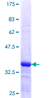 HSPB9 Protein - 12.5% SDS-PAGE Stained with Coomassie Blue.