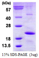 HSPB9 Protein