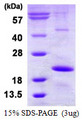 HSPB9 Protein