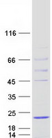 HSPB9 Protein - Purified recombinant protein HSPB9 was analyzed by SDS-PAGE gel and Coomassie Blue Staining
