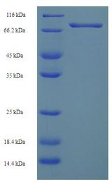 HSPBAP1 Protein