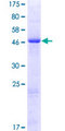 HSPC133 / METTL5 Protein - 12.5% SDS-PAGE of human METTL5 stained with Coomassie Blue