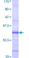 HSPC167 / CDK5RAP1 Protein - 12.5% SDS-PAGE Stained with Coomassie Blue.