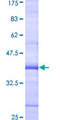 HSPC167 / CDK5RAP1 Protein - 12.5% SDS-PAGE Stained with Coomassie Blue.