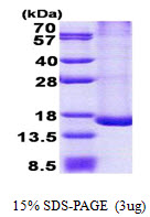 HSPC176 / TRAPPC2L Protein