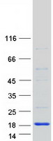 HSPC176 / TRAPPC2L Protein - Purified recombinant protein TRAPPC2L was analyzed by SDS-PAGE gel and Coomassie Blue Staining