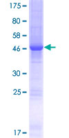 HSpc24 / SPBC24 Protein - 12.5% SDS-PAGE of human SPC24 stained with Coomassie Blue