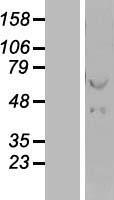 HSPD1 / HSP60 Protein - Western validation with an anti-DDK antibody * L: Control HEK293 lysate R: Over-expression lysate
