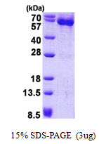 HSPD1 / HSP60 Protein