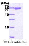 HSPD1 / HSP60 Protein