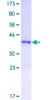 HSPE1 / HSP10 / Chaperonin 10 Protein - 12.5% SDS-PAGE of human HSPE1 stained with Coomassie Blue