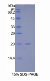 HSPE1 / HSP10 / Chaperonin 10 Protein - Recombinant Heat Shock 10kDa Protein 1 By SDS-PAGE
