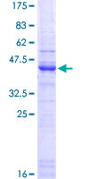 HSPG2 / Perlecan Protein - 12.5% SDS-PAGE Stained with Coomassie Blue.