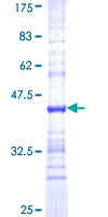 HsT19268 / MTHFS Protein - 12.5% SDS-PAGE Stained with Coomassie Blue.