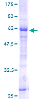 HSU79274 / C12orf24 Protein - 12.5% SDS-PAGE of human HSU79274 stained with Coomassie Blue