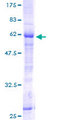 HSU79274 / C12orf24 Protein - 12.5% SDS-PAGE of human HSU79274 stained with Coomassie Blue