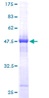 HT036 / HYI Protein - 12.5% SDS-PAGE of human HT036 stained with Coomassie Blue