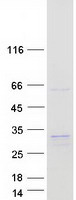HT036 / HYI Protein - Purified recombinant protein HYI was analyzed by SDS-PAGE gel and Coomassie Blue Staining