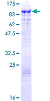 HT2A / TRIM32 Protein - 12.5% SDS-PAGE of human TRIM32 stained with Coomassie Blue