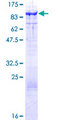 HT2A / TRIM32 Protein - 12.5% SDS-PAGE of human TRIM32 stained with Coomassie Blue