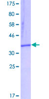 HT2A / TRIM32 Protein - 12.5% SDS-PAGE Stained with Coomassie Blue.