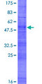 HTPCRX19 / OR7A17 Protein - 12.5% SDS-PAGE of human OR7A17 stained with Coomassie Blue