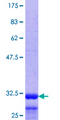 HTR1E / 5-HT1E Receptor Protein - 12.5% SDS-PAGE Stained with Coomassie Blue.
