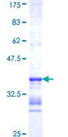 HTR1F / 5-HT1F Receptor Protein - 12.5% SDS-PAGE Stained with Coomassie Blue.