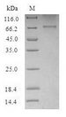 HTR2B / 5-HT2B Receptor Protein - (Tris-Glycine gel) Discontinuous SDS-PAGE (reduced) with 5% enrichment gel and 15% separation gel.