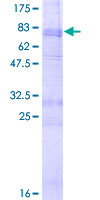 HTR2B / 5-HT2B Receptor Protein - 12.5% SDS-PAGE of human HTR2B stained with Coomassie Blue