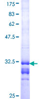 HTR2B / 5-HT2B Receptor Protein - 12.5% SDS-PAGE Stained with Coomassie Blue.
