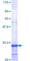 HTR2C / 5-HT2C Receptor Protein - 12.5% SDS-PAGE Stained with Coomassie Blue.