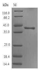 HTR3D / 5HT3D Receptor Protein - (Tris-Glycine gel) Discontinuous SDS-PAGE (reduced) with 5% enrichment gel and 15% separation gel.