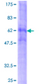 HTR4 / 5-HT4 Receptor Protein - 12.5% SDS-PAGE of human HTR4 stained with Coomassie Blue