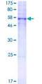 HTR5A / 5-HT5A Receptor Protein - 12.5% SDS-PAGE of human HTR5A stained with Coomassie Blue