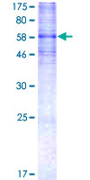 HTR7 / 5HT7 Receptor Protein - 12.5% SDS-PAGE of human HTR7 stained with Coomassie Blue