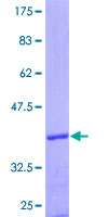 HTR7 / 5HT7 Receptor Protein - 12.5% SDS-PAGE Stained with Coomassie Blue.