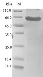 HTRA1 Protein - (Tris-Glycine gel) Discontinuous SDS-PAGE (reduced) with 5% enrichment gel and 15% separation gel.