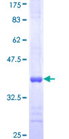 HTRA2 / OMI Protein - 12.5% SDS-PAGE Stained with Coomassie Blue.