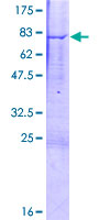 HTRA4 Protein - 12.5% SDS-PAGE of human HTRA4 stained with Coomassie Blue