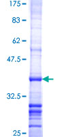 HTS1 / ST5 Protein - 12.5% SDS-PAGE Stained with Coomassie Blue.
