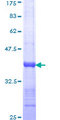 HTT / Huntingtin Protein - 12.5% SDS-PAGE Stained with Coomassie Blue.
